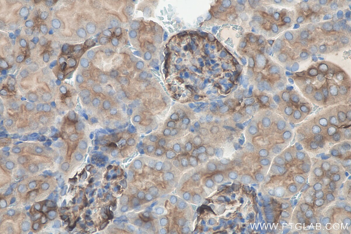 Immunohistochemistry (IHC) staining of mouse kidney tissue using Cd2ap Polyclonal antibody (24122-1-AP)