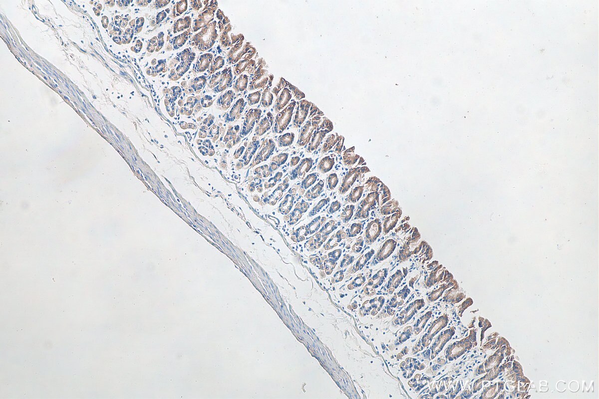 Immunohistochemistry (IHC) staining of mouse stomach tissue using Cd2ap Polyclonal antibody (24122-1-AP)