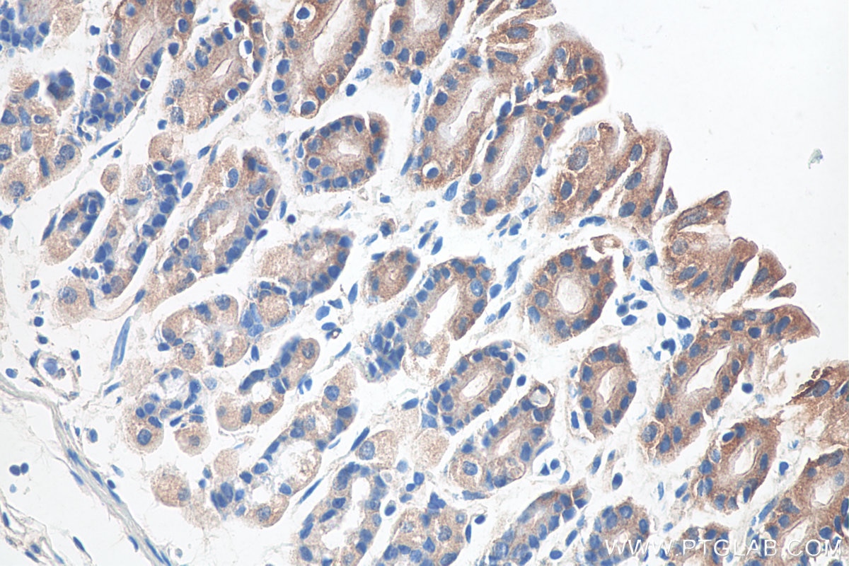 Immunohistochemistry (IHC) staining of mouse stomach tissue using Cd2ap Polyclonal antibody (24122-1-AP)