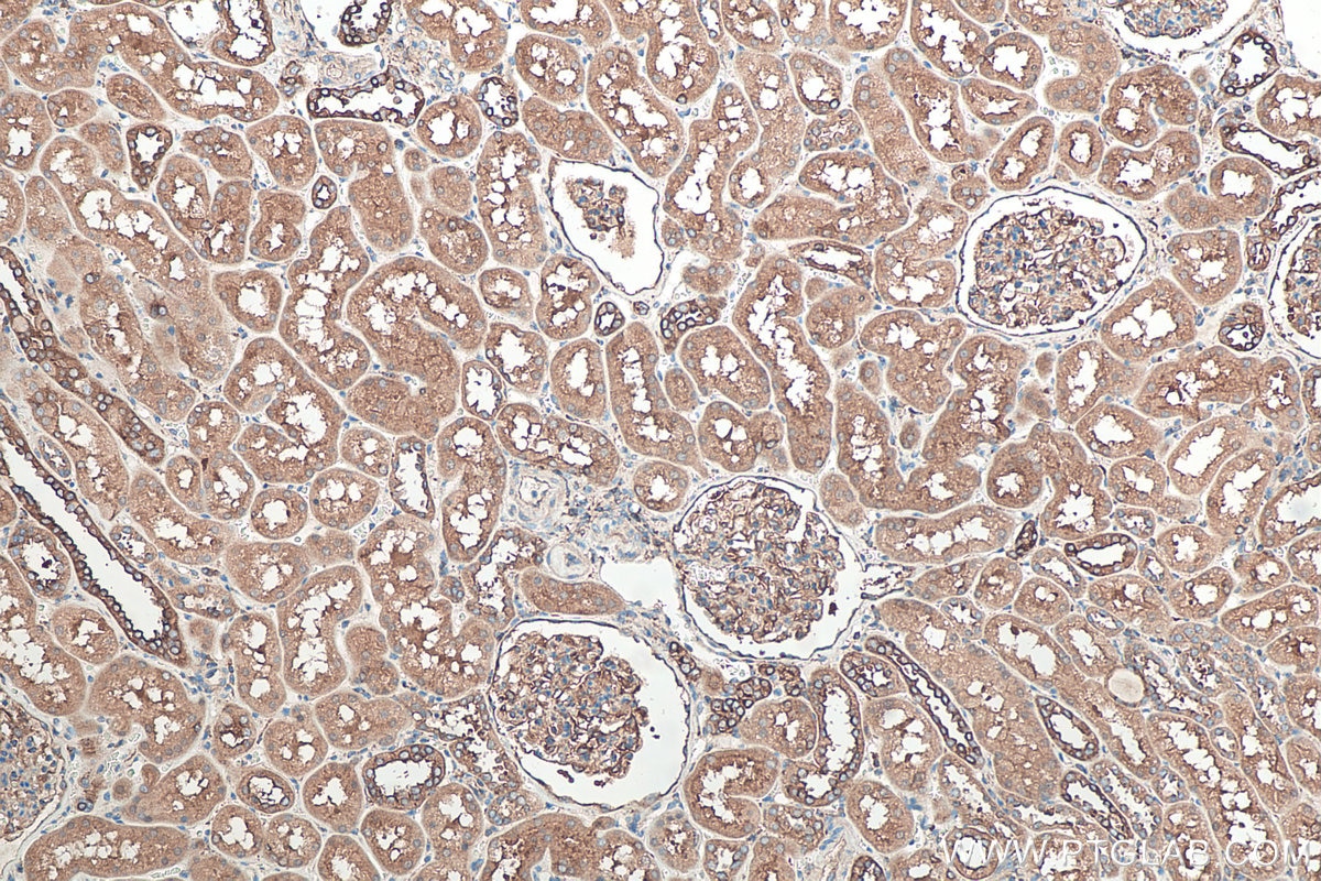 Immunohistochemistry (IHC) staining of human kidney tissue using Cd2ap Polyclonal antibody (24122-1-AP)