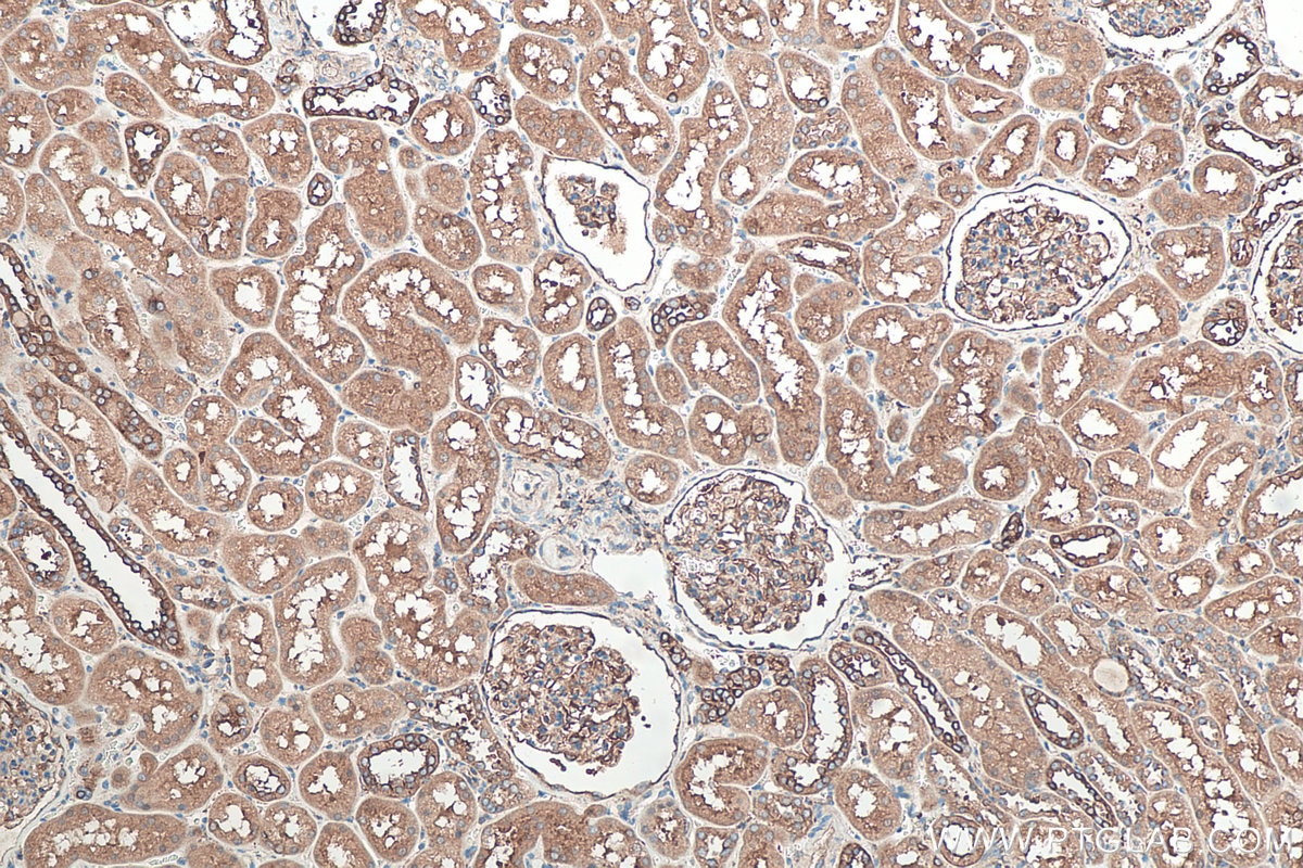 IHC staining of human kidney using 24122-1-AP