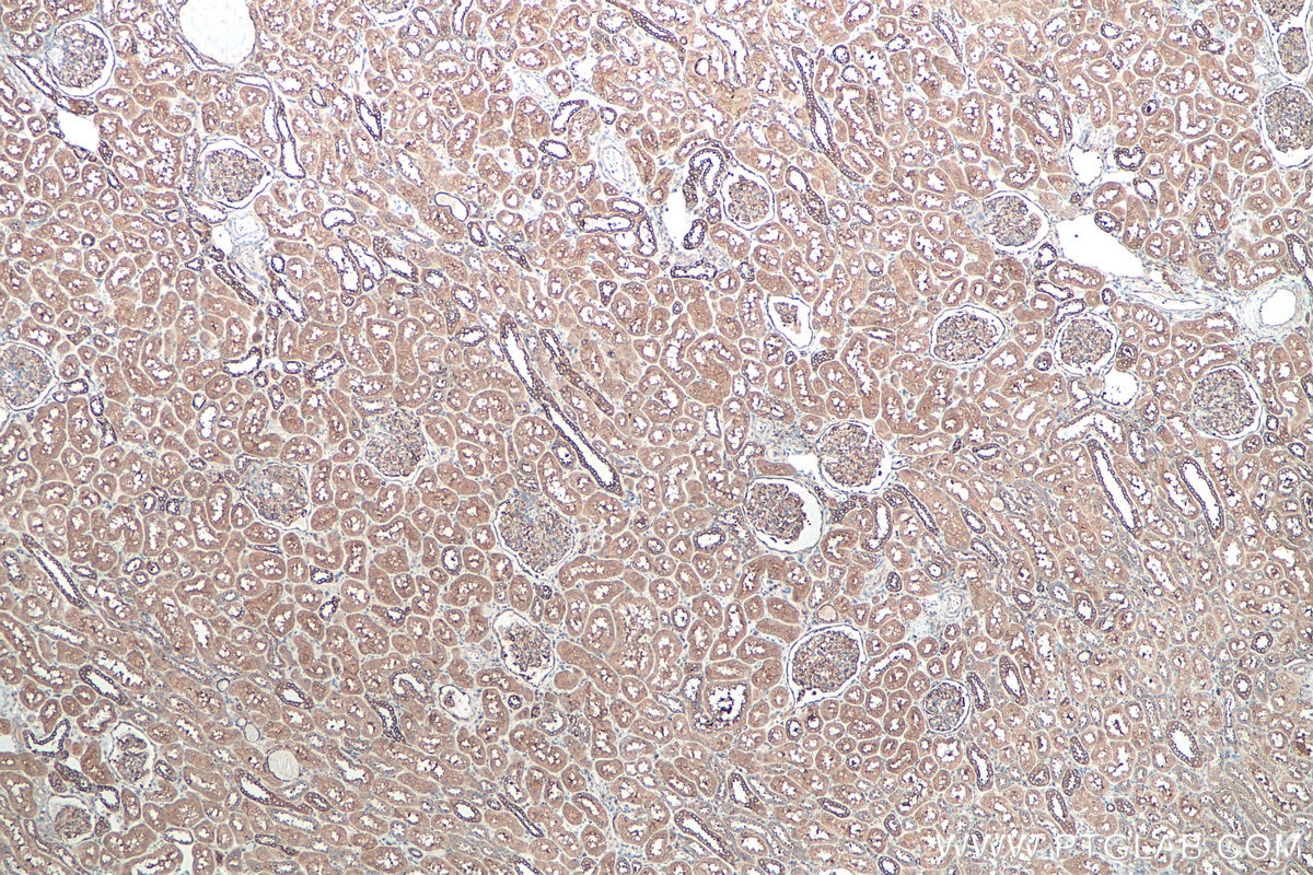 IHC staining of human kidney using 24122-1-AP