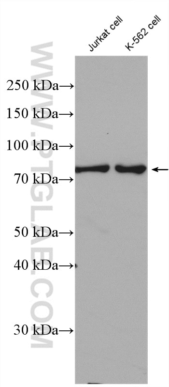 Western Blot (WB) analysis of various lysates using Cd2ap Polyclonal antibody (24122-1-AP)