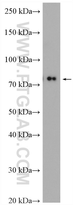 Western Blot (WB) analysis of mouse kidney tissue using Cd2ap Polyclonal antibody (24122-1-AP)