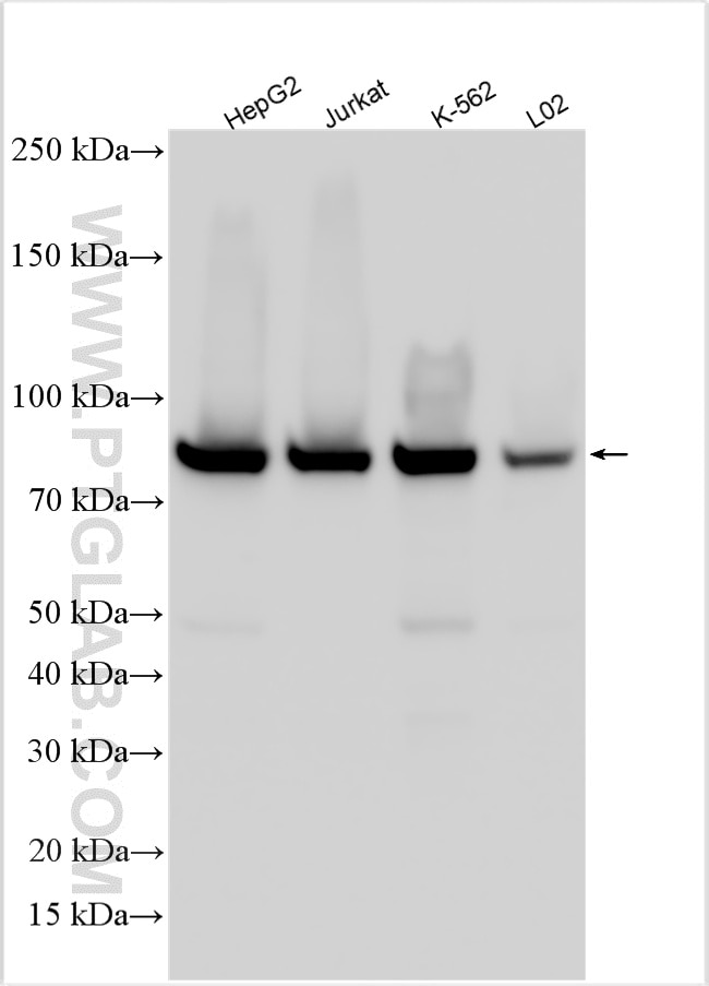 WB analysis using 24122-1-AP Western Blot (WB) analysis of various lysates using CD2AP Polyclonal antibody (24122-1-AP)