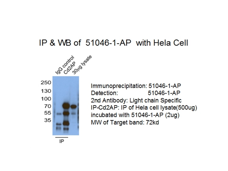Immunoprecipitation (IP) experiment of HeLa cells using Cd2ap Polyclonal antibody (51046-1-AP)
