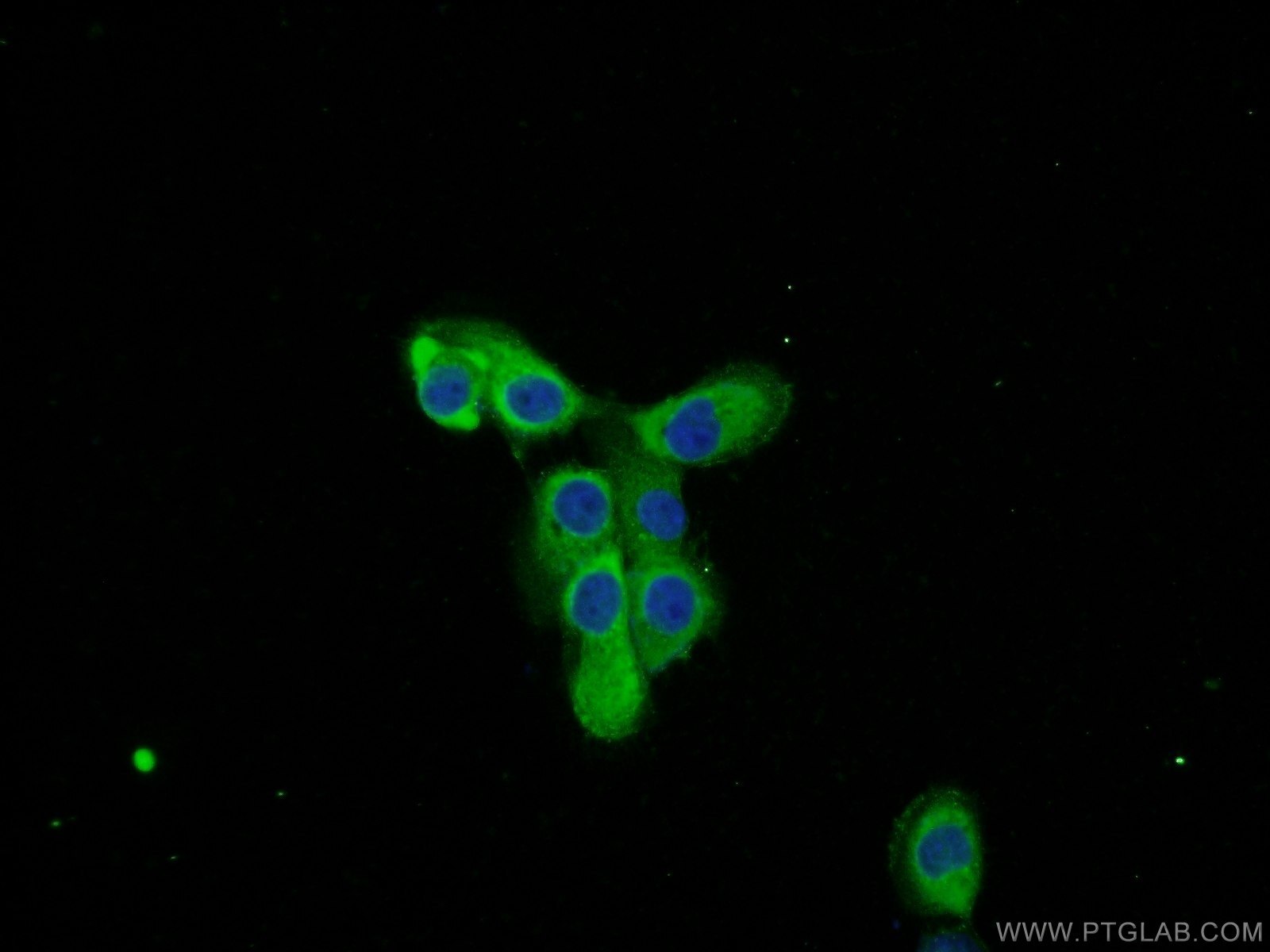 Immunofluorescence (IF) / fluorescent staining of A431 cells using Cd2ap Polyclonal antibody (51046-1-AP)