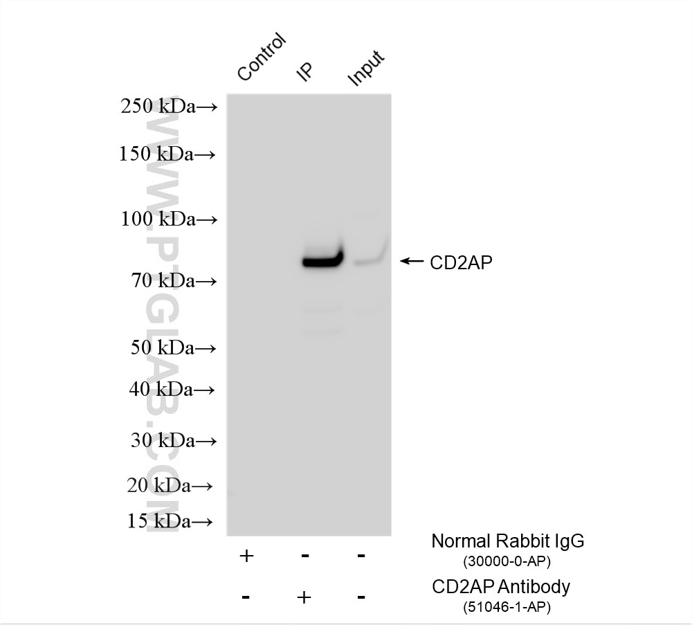 IP experiment of mouse brain using 51046-1-AP Immunoprecipitation (IP) experiment of mouse brain tissue using CD2AP Polyclonal antibody (51046-1-AP)