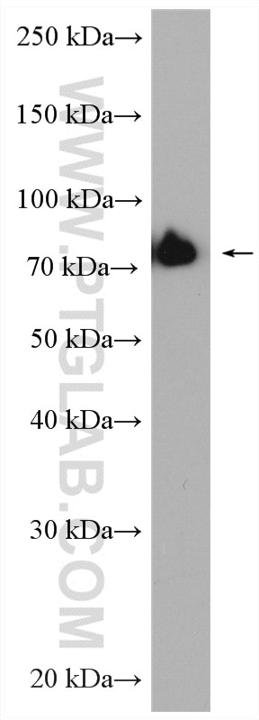 Western Blot (WB) analysis of Jurkat cells using Cd2ap Polyclonal antibody (51046-1-AP)