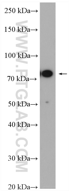 WB analysis of mouse kidney using 51046-1-AP