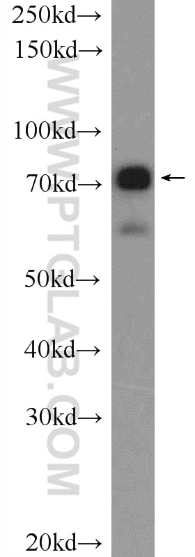 Western Blot (WB) analysis of mouse brain tissue using Cd2ap Polyclonal antibody (51046-1-AP)