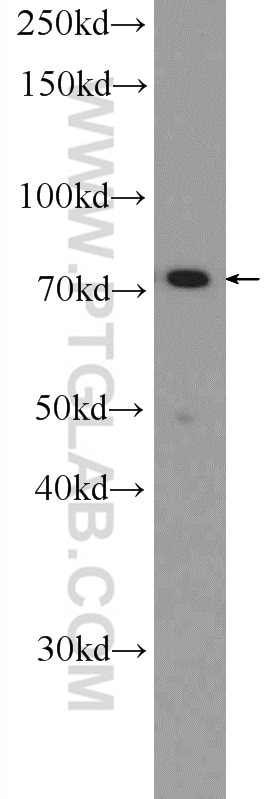 Western Blot (WB) analysis of HeLa cells using Cd2ap Polyclonal antibody (51046-1-AP)