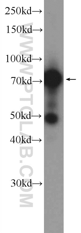 Western Blot (WB) analysis of A431 cells using Cd2ap Polyclonal antibody (51046-1-AP)