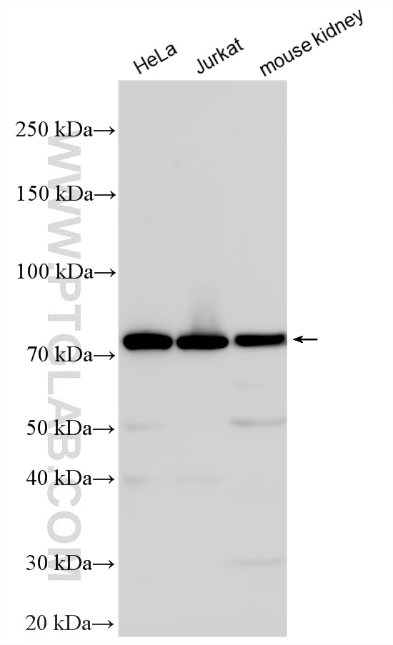 Western Blot (WB) analysis of various lysates using CD2AP Polyclonal antibody (51046-1-AP)