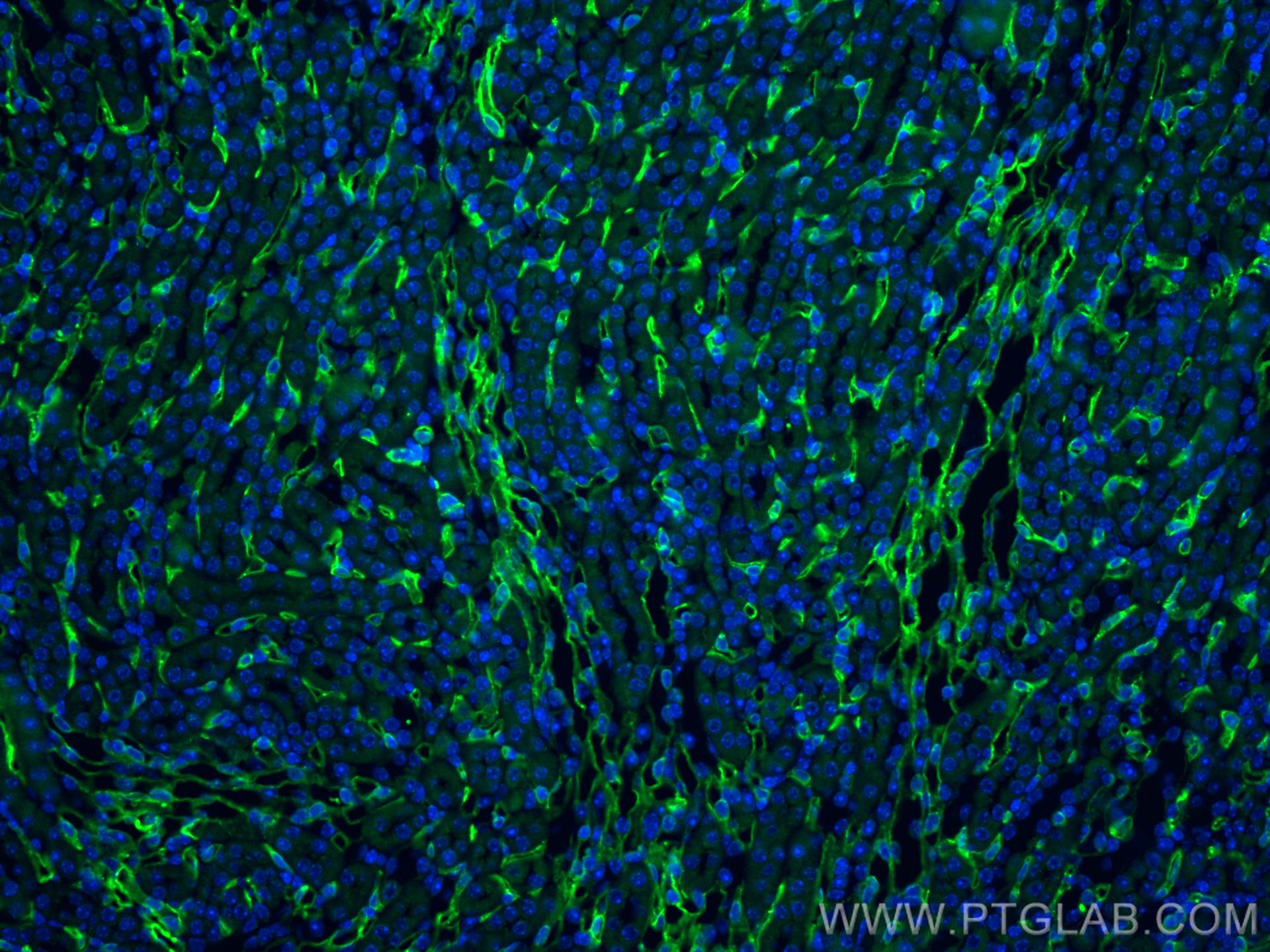 Immunofluorescence (IF) / fluorescent staining of mouse kidney tissue using CD31 Polyclonal antibody (28083-1-AP)