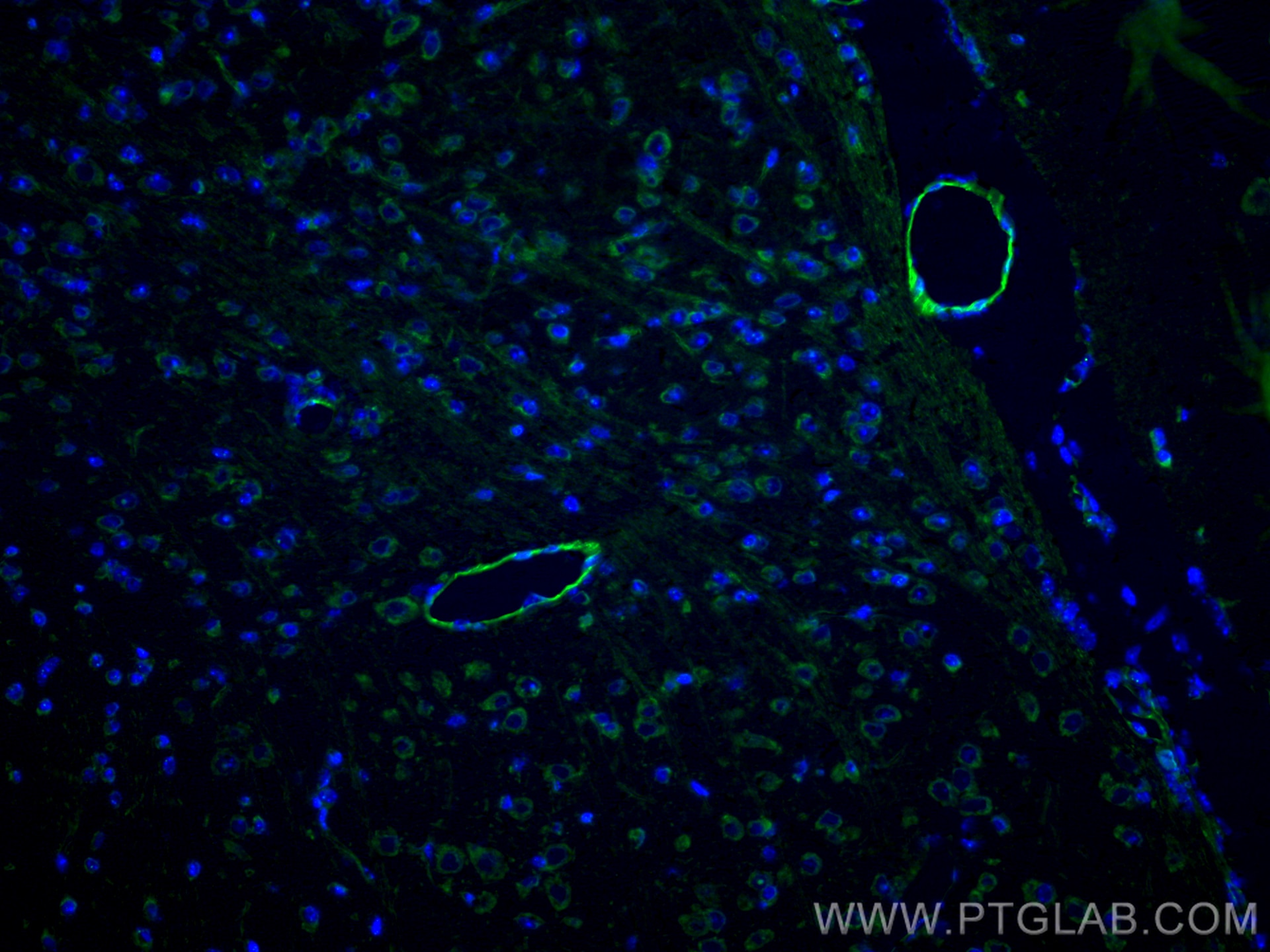 Immunofluorescence (IF) / fluorescent staining of mouse brain tissue using CD31 Polyclonal antibody (28083-1-AP)