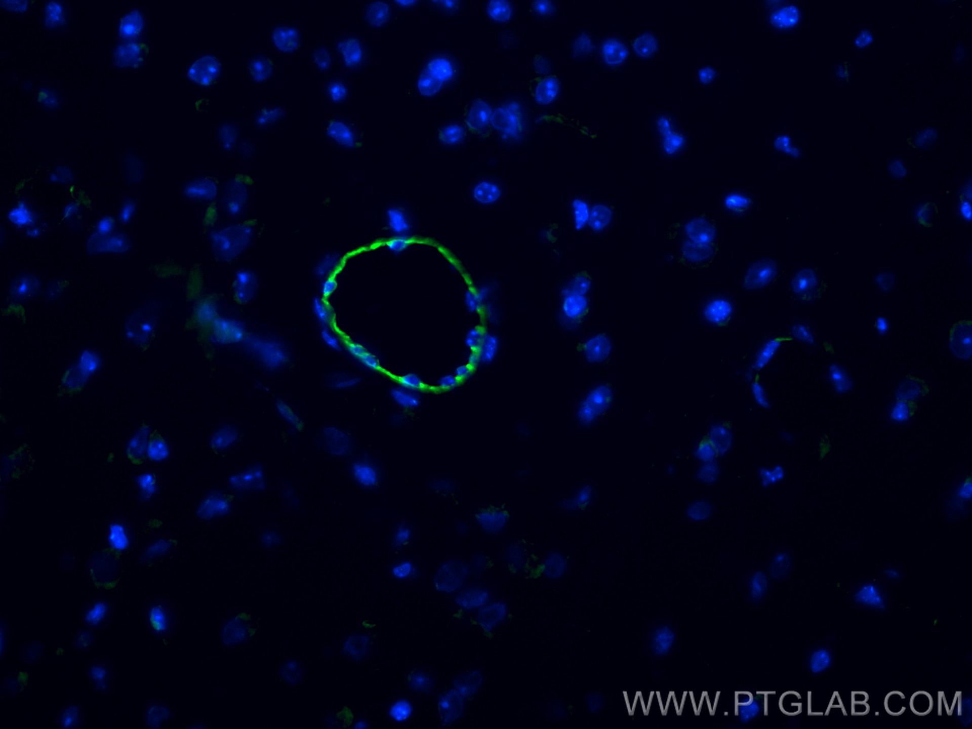 Immunofluorescence (IF) / fluorescent staining of mouse brain tissue using CD31 Polyclonal antibody (28083-1-AP)