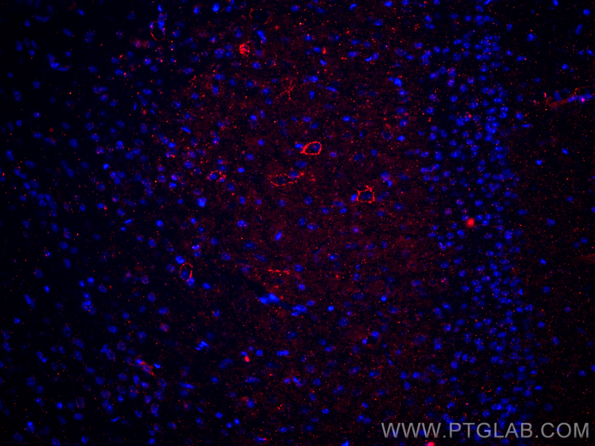 Immunofluorescence (IF) / fluorescent staining of mouse brain tissue using CD31 Polyclonal antibody (28083-1-AP)