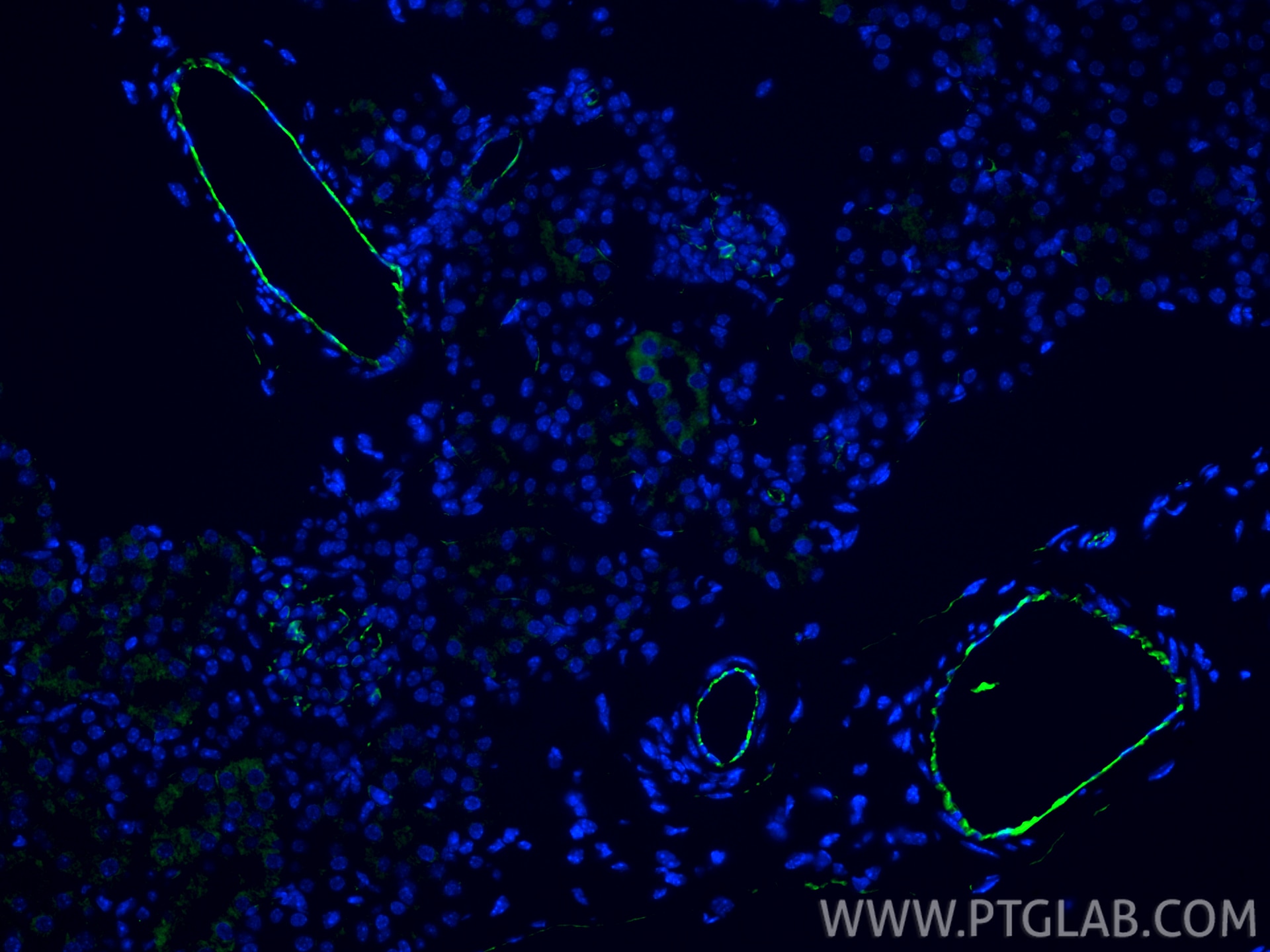 Immunofluorescent analysis of (4% PFA) fixed paraffin-embedded mouse kidney tissue using CD31 antibody (28083-1-AP) at dilution of 1:200 and CoraLite®488-Conjugated Goat Anti-Rabbit IgG(H+L) (SA00013-2). Heat mediated antigen retrieval with Tris-EDTA buffer (pH 9.0). Immunofluorescence (IF) / fluorescent staining of mouse kidney tissue using CD31 Polyclonal antibody (28083-1-AP)