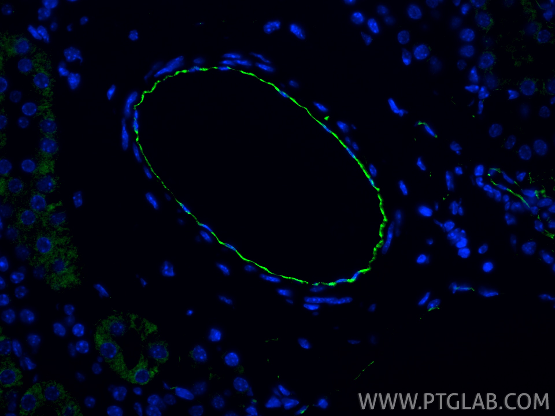 Immunofluorescent analysis of (4% PFA) fixed paraffin-embedded mouse kidney tissue using CD31 antibody (28083-1-AP) at dilution of 1:200 and CoraLite®488-Conjugated Goat Anti-Rabbit IgG(H+L) (SA00013-2). Heat mediated antigen retrieval with Tris-EDTA buffer (pH 9.0). Immunofluorescence (IF) / fluorescent staining of mouse kidney tissue using CD31 Polyclonal antibody (28083-1-AP)