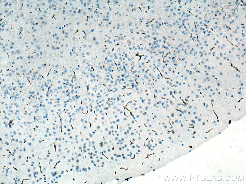 Immunohistochemistry (IHC) staining of mouse brain tissue using CD31 Polyclonal antibody (28083-1-AP)