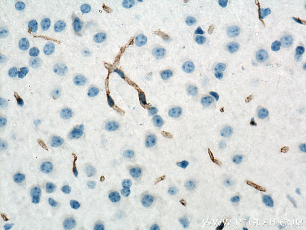 IHC staining of mouse brain using 28083-1-AP