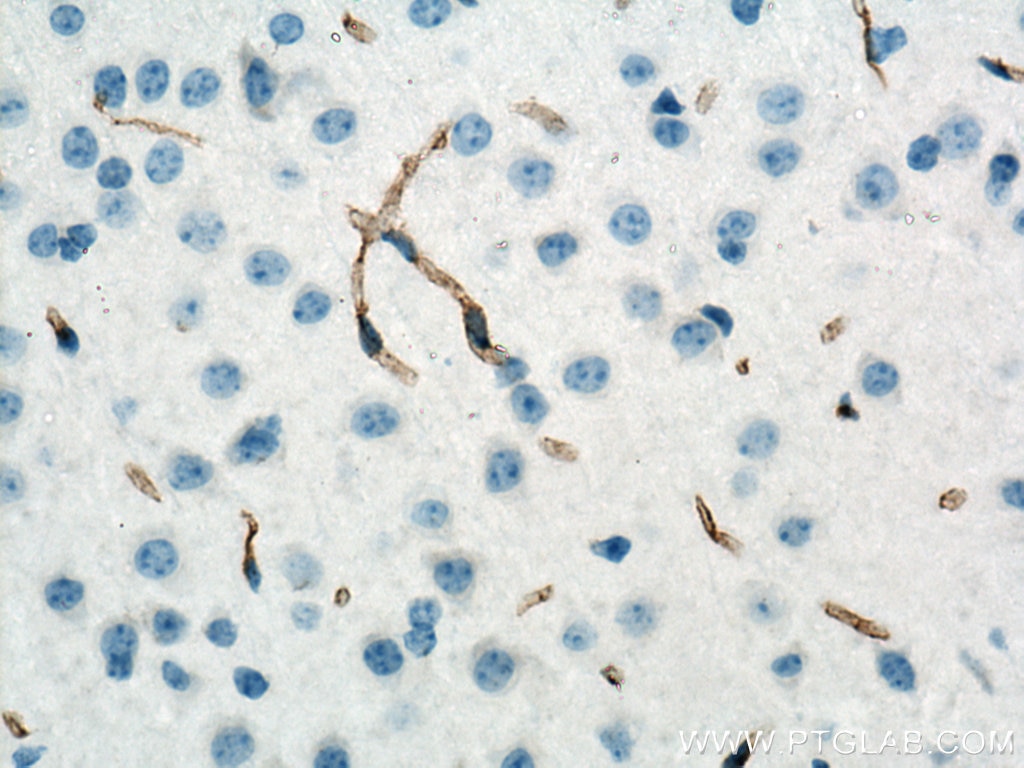 Immunohistochemistry (IHC) staining of mouse brain tissue using CD31 Polyclonal antibody (28083-1-AP)