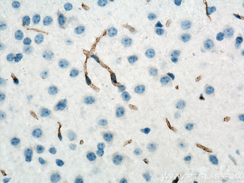 Immunohistochemistry (IHC) staining of mouse brain tissue using CD31 Polyclonal antibody (28083-1-AP)