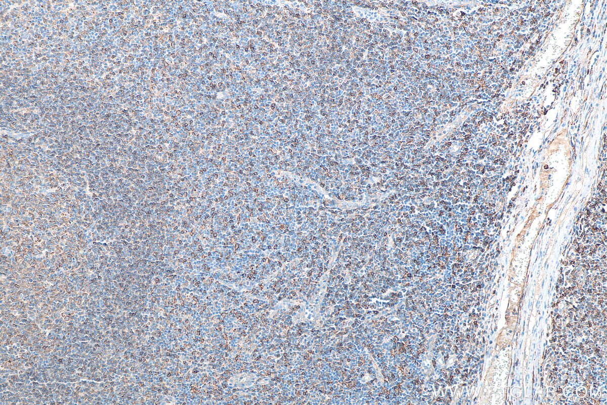cd3129010