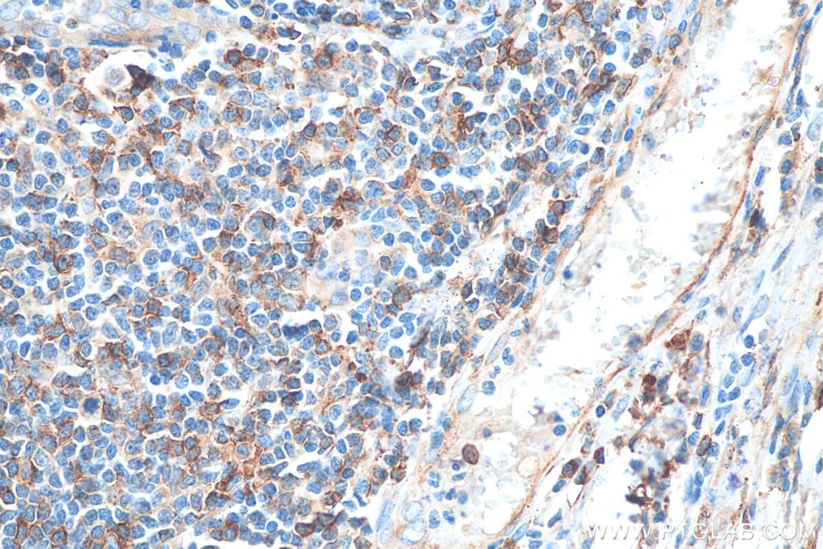 cd3129010