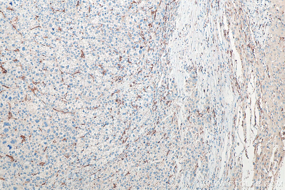cd3129010