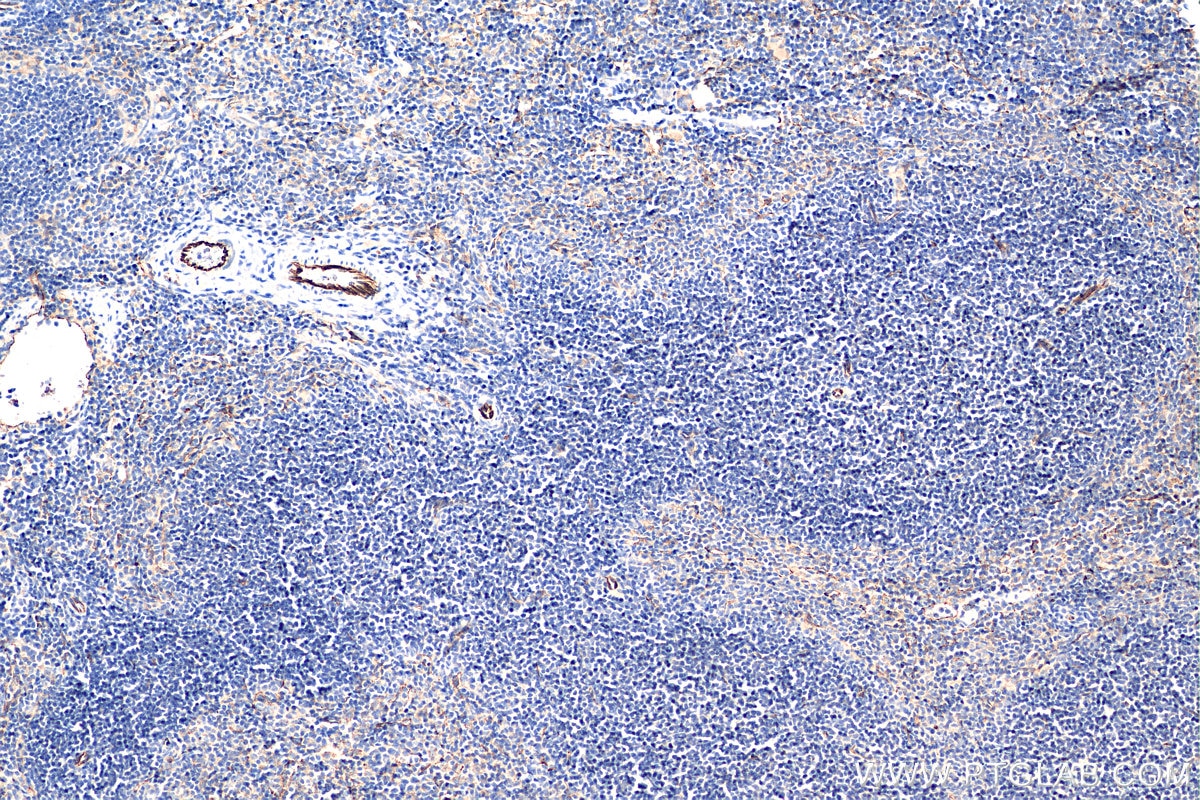 Immunohistochemistry (IHC) staining of mouse spleen tissue using CD31 Polyclonal antibody (28083-1-AP)