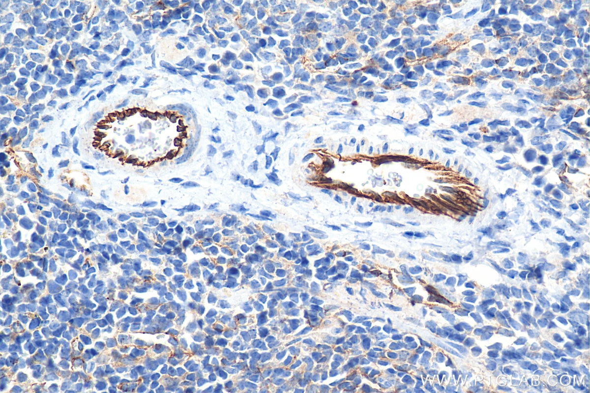Immunohistochemistry (IHC) staining of mouse spleen tissue using CD31 Polyclonal antibody (28083-1-AP)