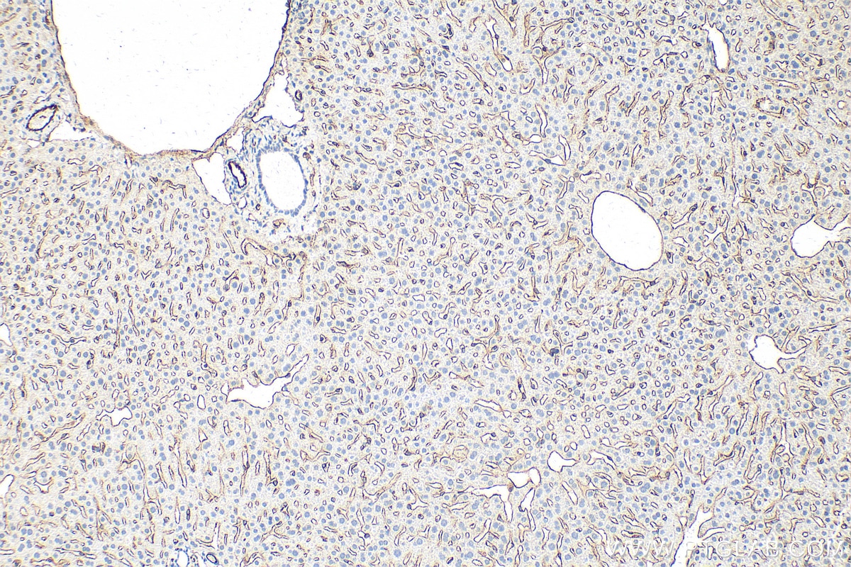 Immunohistochemistry (IHC) staining of mouse liver tissue using CD31 Polyclonal antibody (28083-1-AP)