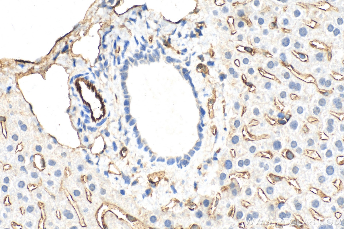 Immunohistochemistry (IHC) staining of mouse liver tissue using CD31 Polyclonal antibody (28083-1-AP)