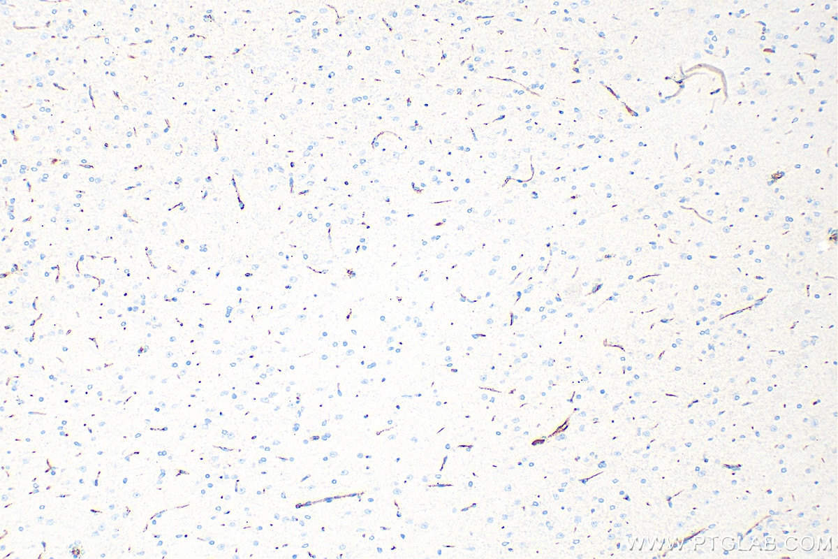 Immunohistochemistry (IHC) staining of rat brain tissue using CD31 Polyclonal antibody (28083-1-AP)