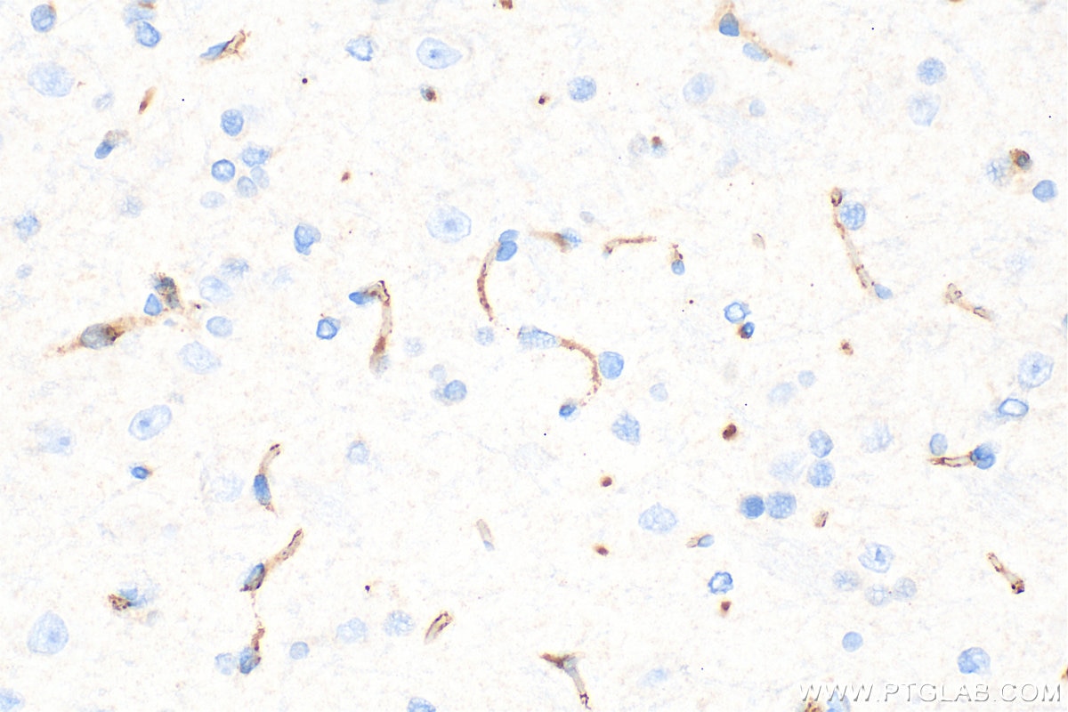 Immunohistochemistry (IHC) staining of rat brain tissue using CD31 Polyclonal antibody (28083-1-AP)