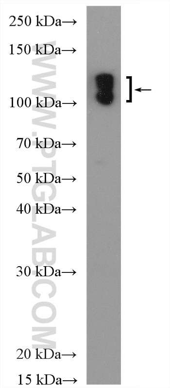 Western Blot (WB) analysis of mouse liver tissue using CD31 Polyclonal antibody (28083-1-AP)