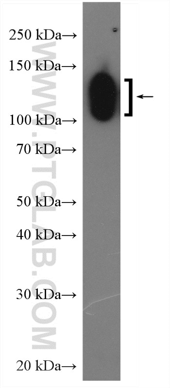 Western Blot (WB) analysis of mouse spleen tissue using CD31 Polyclonal antibody (28083-1-AP)
