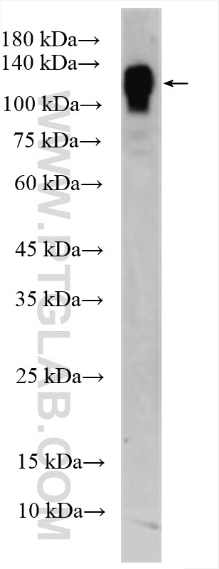 Western Blot (WB) analysis of bEnd.3 cells using CD31 Polyclonal antibody (28083-1-AP)