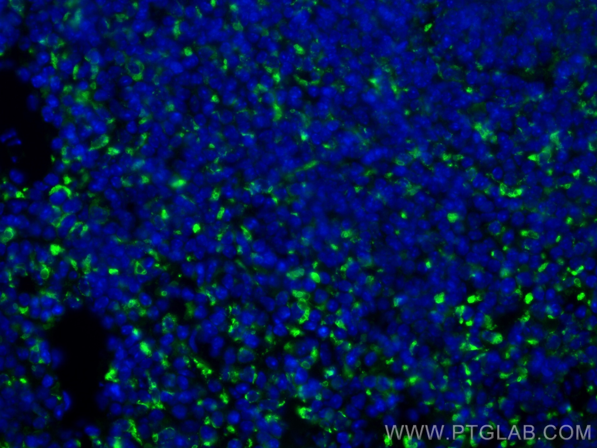 Immunofluorescence (IF) / fluorescent staining of mouse spleen tissue using Cd68 Polyclonal antibody (28058-1-AP)