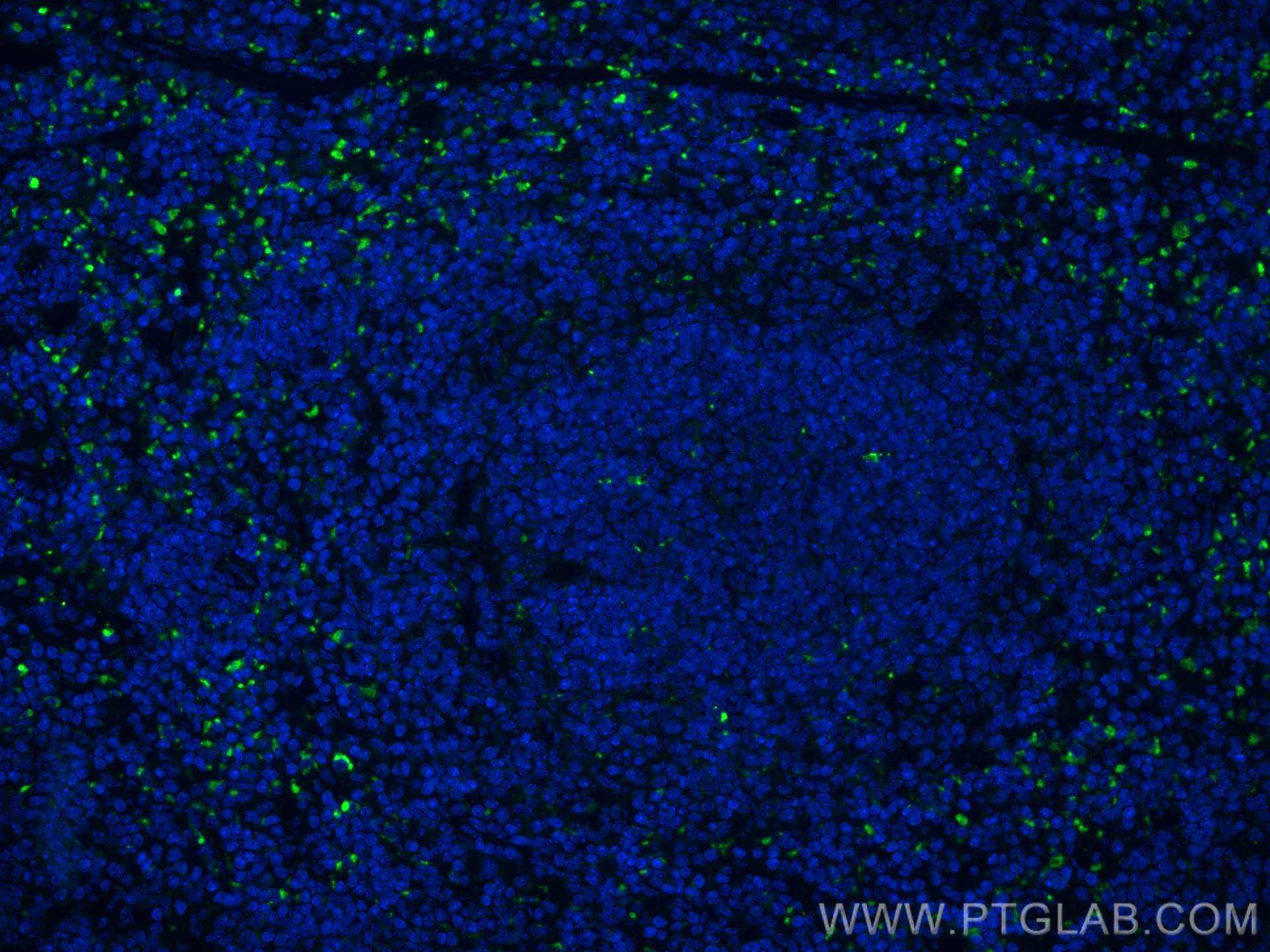 Immunofluorescence (IF) / fluorescent staining of mouse spleen tissue using CD68 Polyclonal antibody (28058-1-AP)