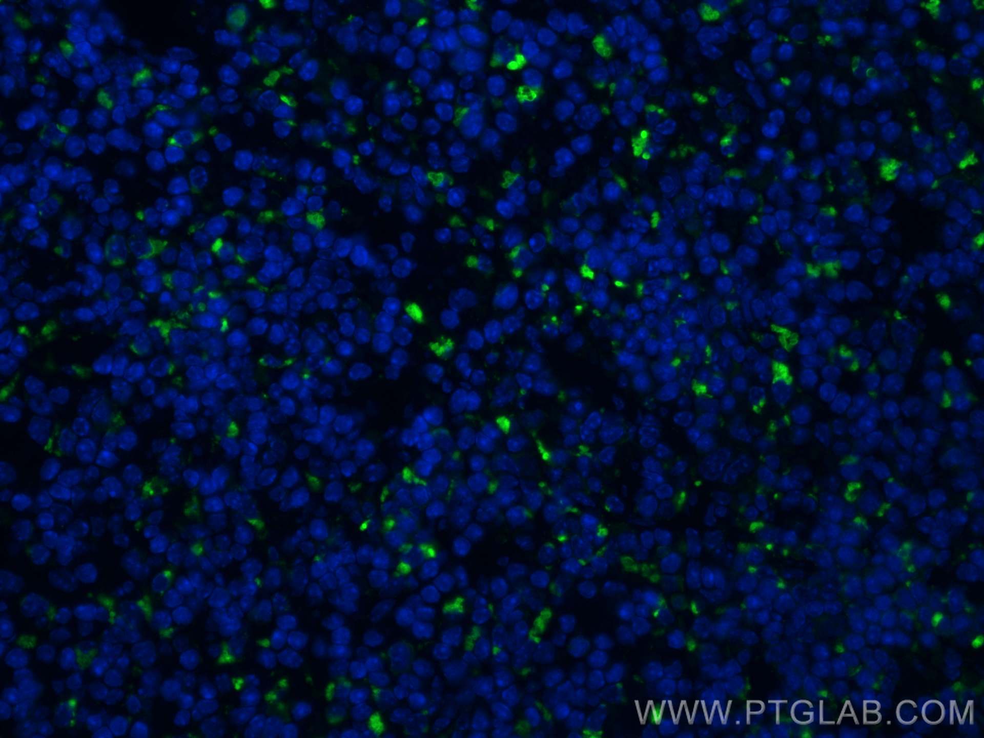 Immunofluorescence (IF) / fluorescent staining of mouse spleen tissue using CD68 Polyclonal antibody (28058-1-AP)