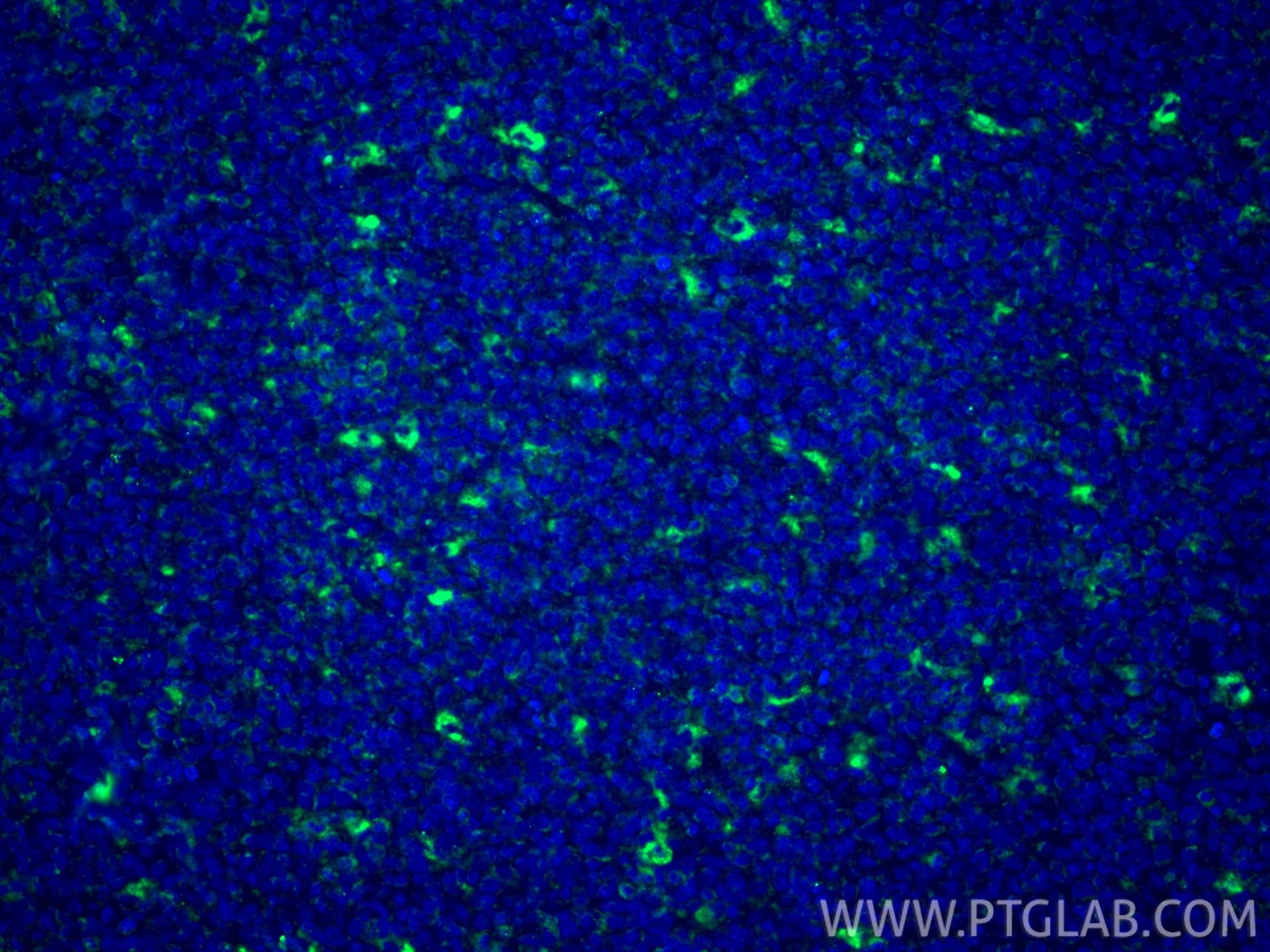 Immunofluorescence (IF) / fluorescent staining of human tonsillitis tissue using CD68 Polyclonal antibody (28058-1-AP)