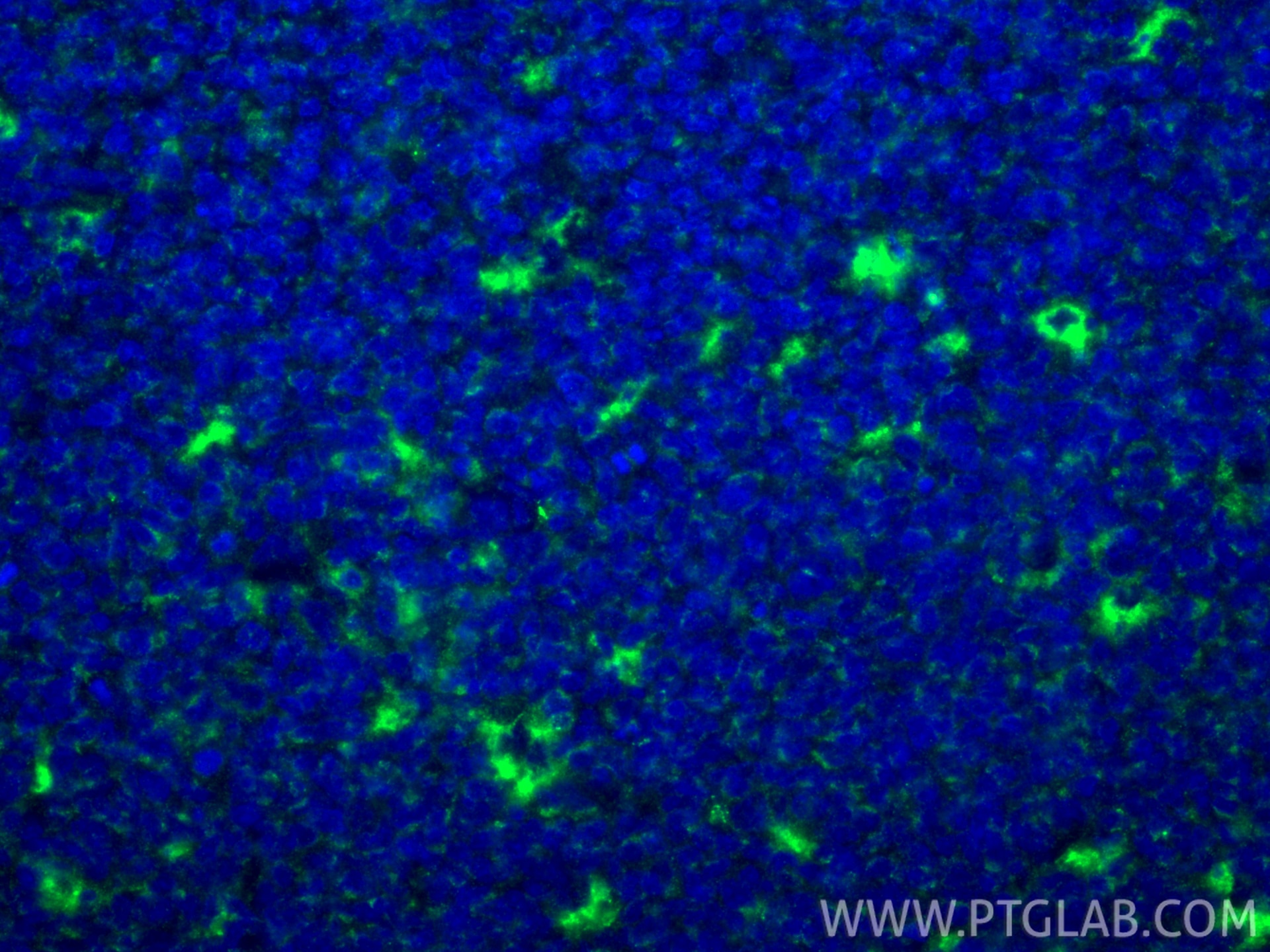 Immunofluorescence (IF) / fluorescent staining of human tonsillitis tissue using CD68 Polyclonal antibody (28058-1-AP)