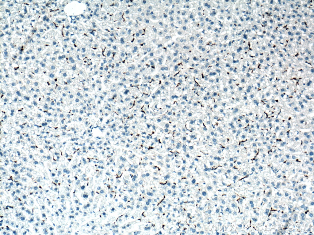 Immunohistochemistry (IHC) staining of mouse liver tissue using CD68 Polyclonal antibody (28058-1-AP)