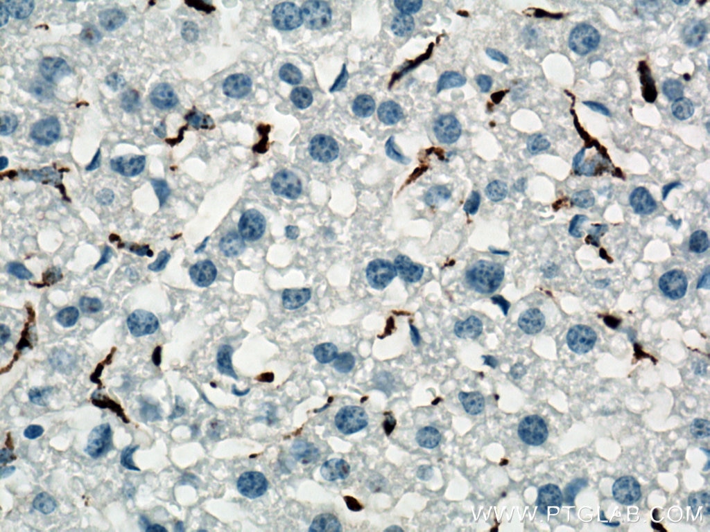 Immunohistochemistry (IHC) staining of mouse liver tissue using CD68 Polyclonal antibody (28058-1-AP)