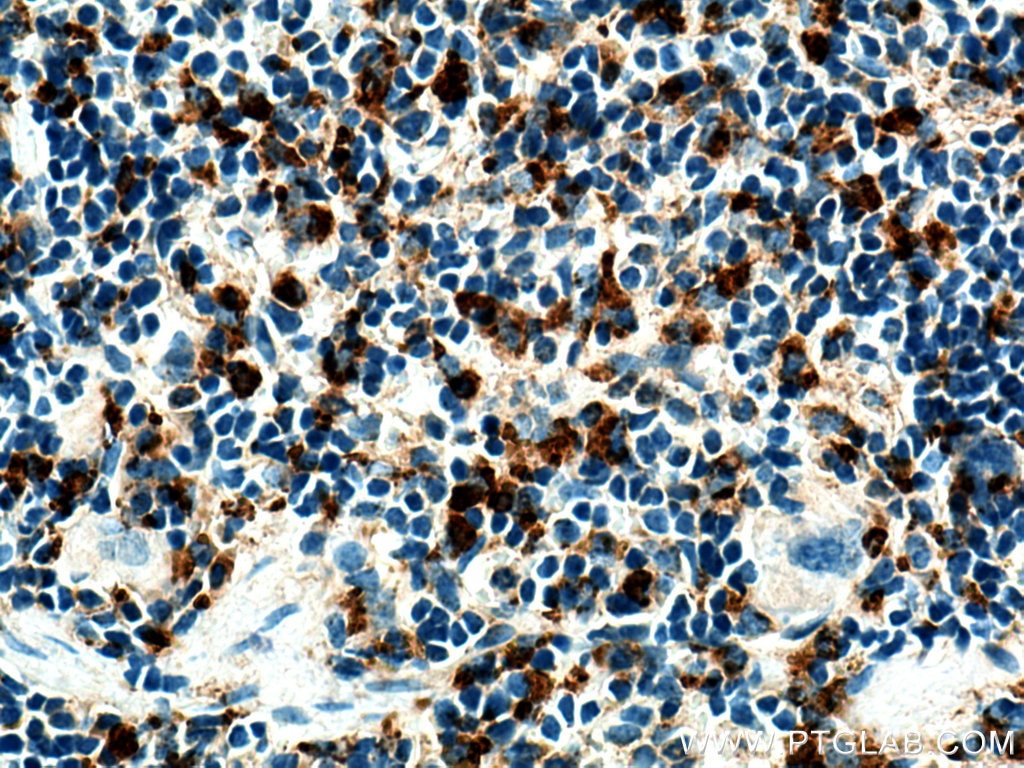 Immunohistochemistry (IHC) staining of mouse spleen tissue using Cd68 Polyclonal antibody (28058-1-AP)