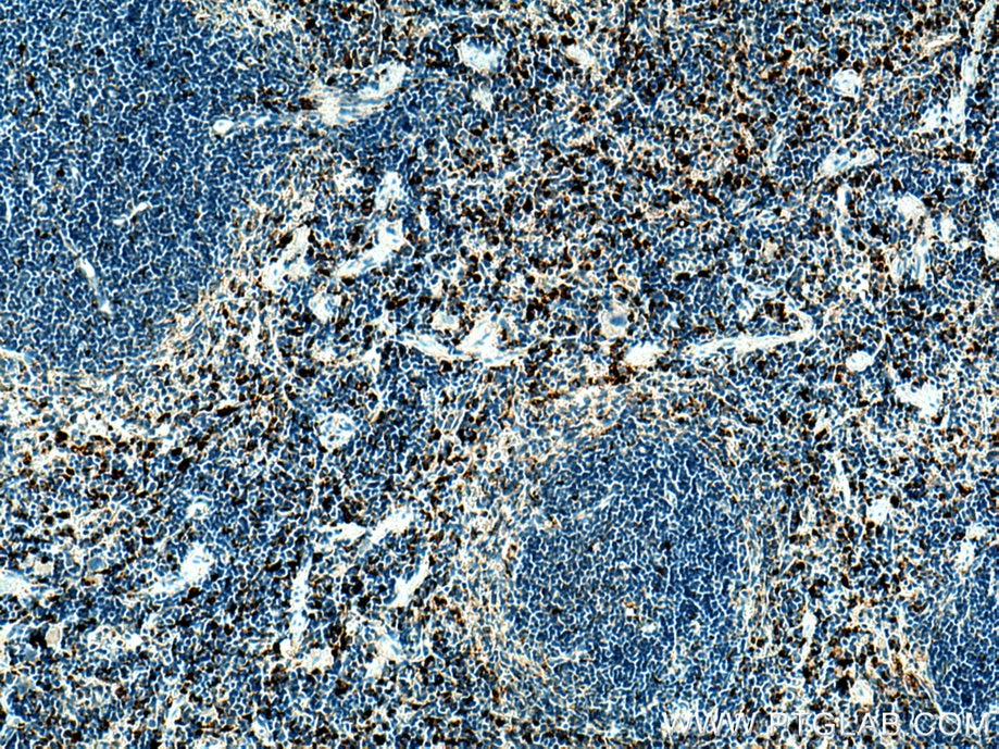 Immunohistochemistry (IHC) staining of mouse spleen tissue using Cd68 Polyclonal antibody (28058-1-AP)