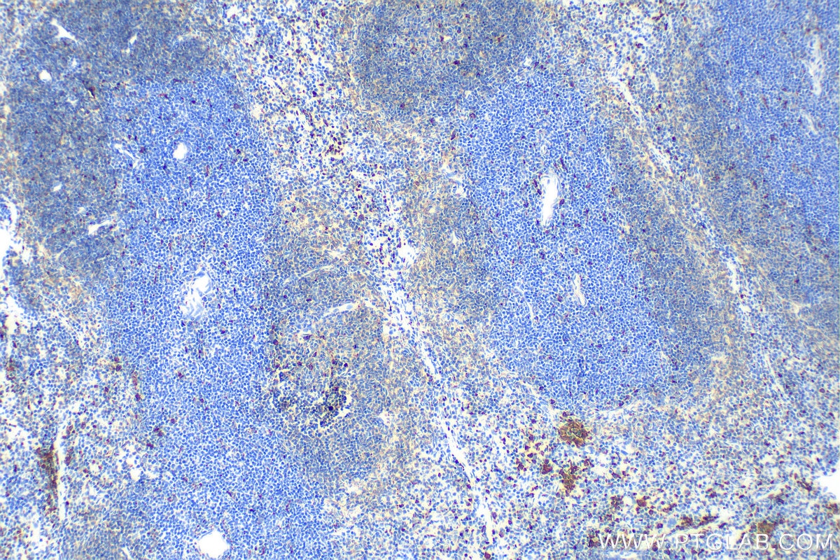 Immunohistochemistry (IHC) staining of mouse spleen tissue using CD68 Polyclonal antibody (28058-1-AP)